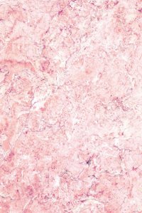 Blossom Pink Dark